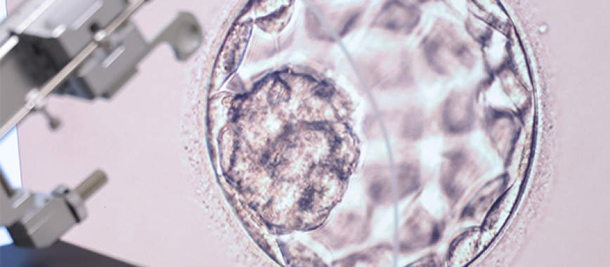Photo of embryo